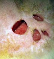 Chronic ulcerative panniculitis in a cat with Actinomycosis