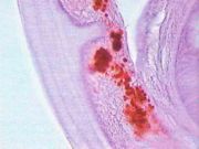 Anti-Wolbachia spp Surface protein (WSP), showing the presence of Wolbachia bacteria within the lateral hypoderma chord of D. immitis female parasite immunohistochemistry. Courtesy August, JR (2010)[1]